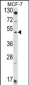 HSD11B2 Antibody (Center)