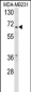 RXRB Antibody (Center)