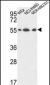 ATP5A1 Antibody (C-term)