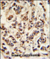 ATP6V1A Antibody (Center)