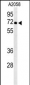ATP6V1A Antibody (Center)