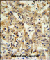 CA6 Antibody (C-term)