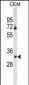 CA6 Antibody (C-term)