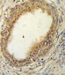 HAPLN1 Antibody (N-term)
