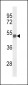 FOXG1 Antibody (Center)