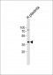 IDH3G Antibody (C-term)