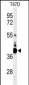 VTCN1 Antibody (Center)