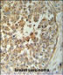 TM173 Antibody (C-term)