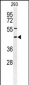 STX1A Antibody (N-term)