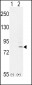 FGFR1-Y307 Antibody