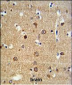 ADAM19 Antibody (Center)