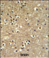 ETS2 Antibody (Center)