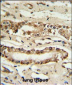 FOXP1 Antibody (C-term)