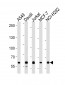 FOXP1 Antibody (C-term)