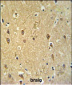GPR17 Antibody (Center)