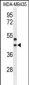 GPR17 Antibody (Center)