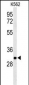 PGP Antibody (N-term)