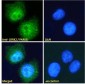 Goat Anti-LRRK2 / PARK8 (near C Terminus) Antibody