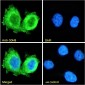 Goat Anti-SDHB Antibody