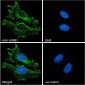 Goat Anti-ADRB1 Antibody
