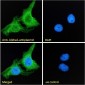 Goat Anti-Alpha2-antiplasmin Antibody