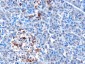 Goat Anti-MDA5 / IFIH1 Antibody