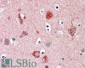 Goat Anti-MUNC18 / STXBP1 (isoform a) Antibody