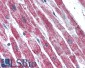 Goat Anti-SDHB Antibody