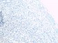 Goat Anti-ADRB1 Antibody
