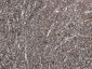 Goat Anti-ADRB1 Antibody