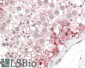 Goat Anti-ABCD3 Antibody