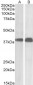 Goat Anti-SET / I2 alpha PP2A Antibody