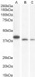 Goat Anti-BIF-1 / SH3GLB1 Antibody