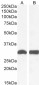 Goat Anti-NQO1 Antibody