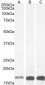 Goat Anti-AIF1 / IBA1 (isoform 1 and 3) Antibody