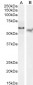 Goat Anti-TFEB (N Terminus) Antibody