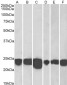 Goat Anti-PARK7 / DJ-1 Antibody