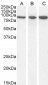 Goat Anti-VPS35 / MEM3 Antibody