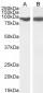 Goat Anti-VPS35 / MEM3 Antibody