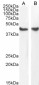 Goat Anti-Smooth muscle alpha-actin Antibody