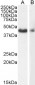 Goat Anti-Smooth muscle alpha-actin Antibody