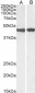 Goat Anti-Smooth muscle alpha-actin Antibody