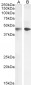 Goat Anti-Smooth muscle alpha-actin Antibody