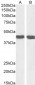 Goat Anti-Smooth muscle alpha-actin Antibody