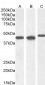 Goat Anti-Smooth muscle alpha-actin Antibody