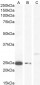 Goat Anti-COMT (N Terminus) Antibody