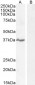 Goat Anti-NKG2D / KLRK1 Antibody