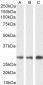 Goat Anti-SDHB Antibody