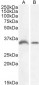 Goat Anti-GDF15 Antibody