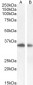 Goat Anti-TIM3 / HAVCR2 Antibody